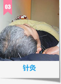 针灸